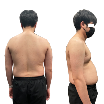 30代男性Before