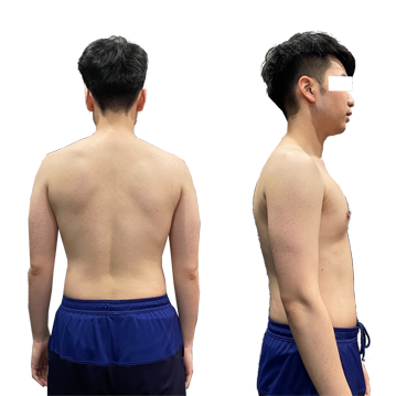 30代男性After